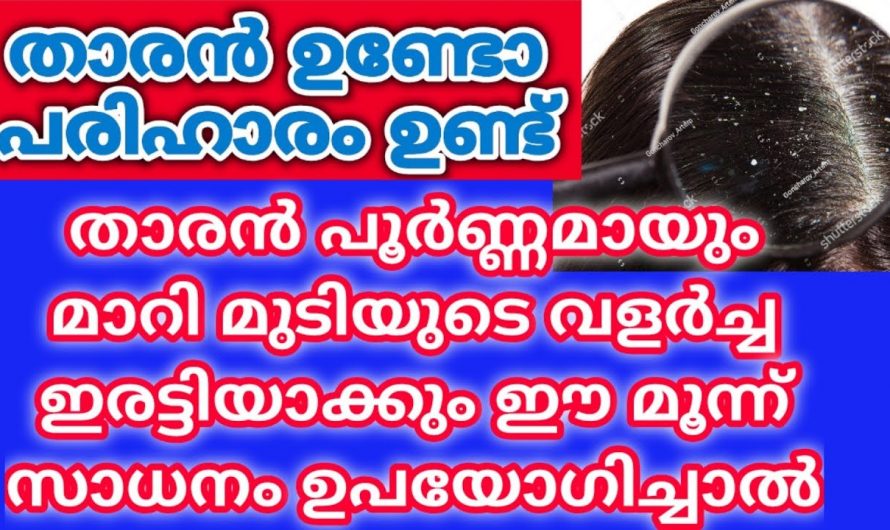 തലമുടിയിലെ താരൻ പരിഹരിച്ചു മുടിയെ സംരക്ഷിക്കാൻ..