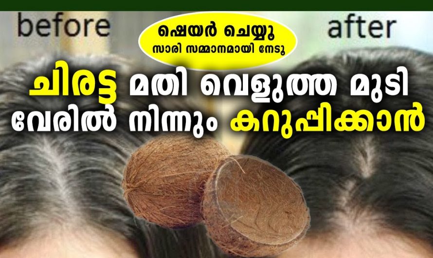 മുടിയിലെ നര പരിഹരിച്ചു മുടിയെ സംരക്ഷിക്കാൻ