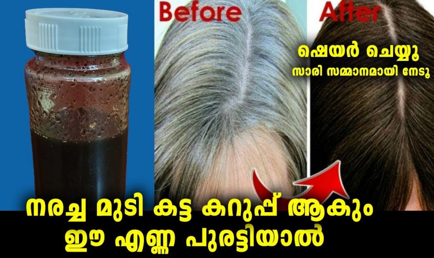 മുടിയിലെ നര പരിഹരിച്ച് മുടിയെ സംരക്ഷിക്കാൻ.