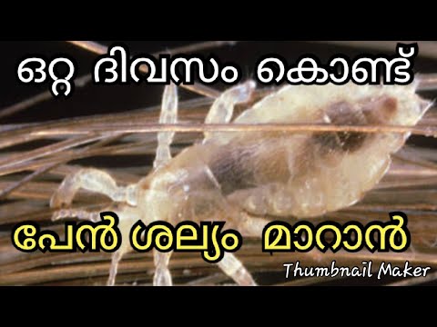 പേൻ ശല്യം ഇല്ലാതാക്കി മുടിയെ സംരക്ഷിക്കാൻ..