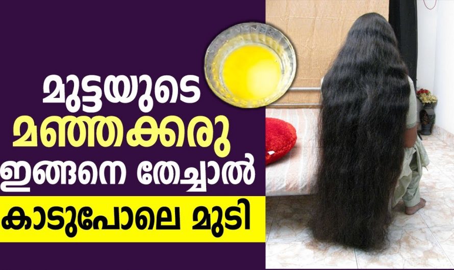 നല്ല ആരോഗ്യമുള്ള കരുത്തുള്ള കറുത്ത മുടിയഴകൾ ലഭിക്കുന്നതിന്..