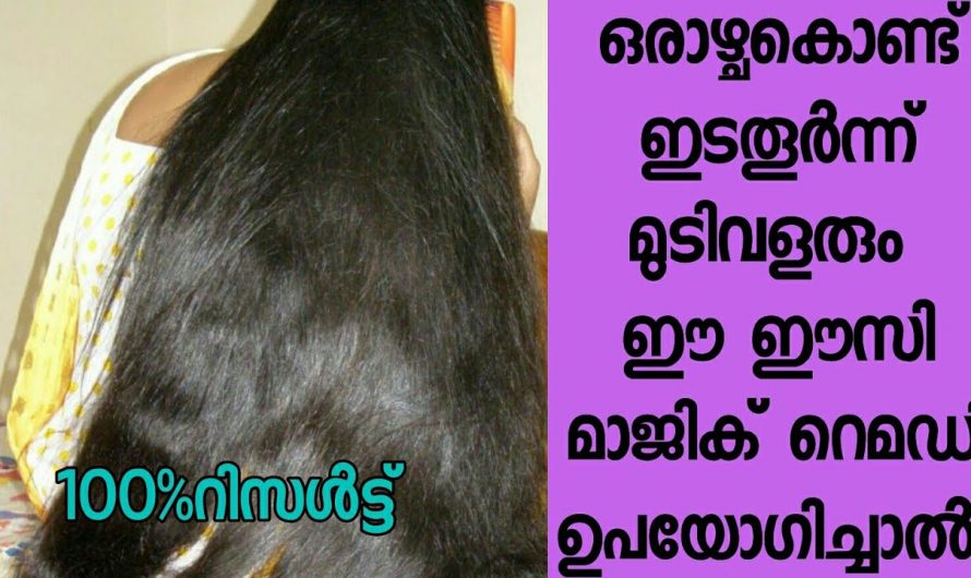 മുടി വളർച്ച ഇരട്ടിയാക്കുന്നതിന് മുടികൊഴിച്ചിൽ തടയാനും…