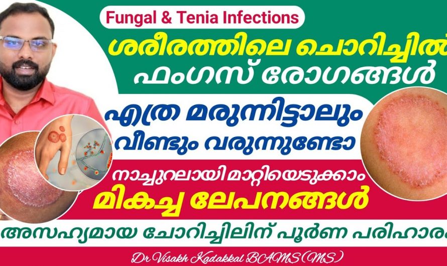 ശരീരഭാഗങ്ങളിൽ ചൊറിച്ചിൽ അനുഭവപ്പെടുന്നതിന് കാരണങ്ങളും പരിഹാരങ്ങളും.