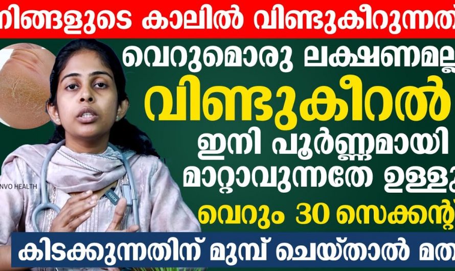 ആയുർവേദ വിധിപ്രകാരം കാലുകൾ വീണ്ടുകീറുന്നത് എങ്ങനെ പരിഹാരം കാണാം