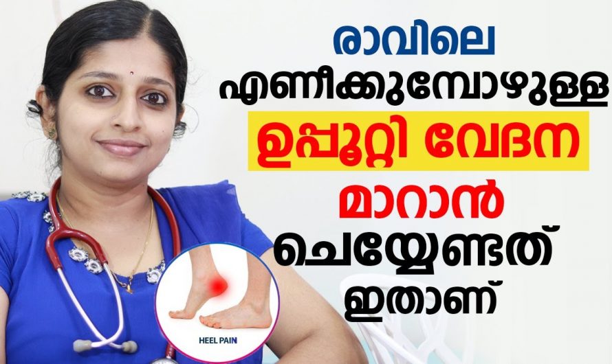 ഉപ്പൂറ്റി വേദന വളരെ എളുപ്പത്തിൽ പരിഹരിക്കാൻ…