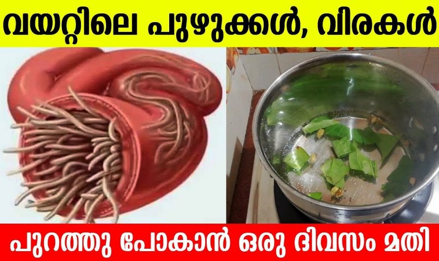 കുട്ടികളിലെയും മുതിർന്നവരെയും വിരശല്യം പൂർണമായും ഒഴിവാക്കാം…