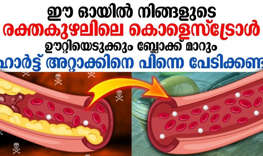 കൊളസ്ട്രോൾ വരില്ല, അറ്റാക്ക് പ്രതിരോധിക്കും ഭക്ഷണത്തിലെ ഒരു കാര്യം നിർബന്ധമാക്കിയാൽ മതി..