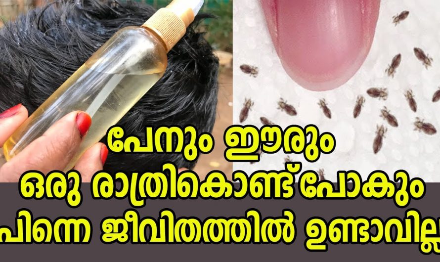 ഒറ്റരാത്രികൊണ്ട് പേനിനെയും ഇരിനെയും ഇല്ലാതാക്കാം