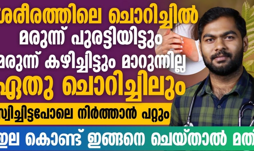 സോറിയാസിസ് പോലെയുള്ള ആരോഗ്യപ്രശ്നങ്ങൾ പ്രശ്നങ്ങൾ പരിഹരിക്കാൻ.