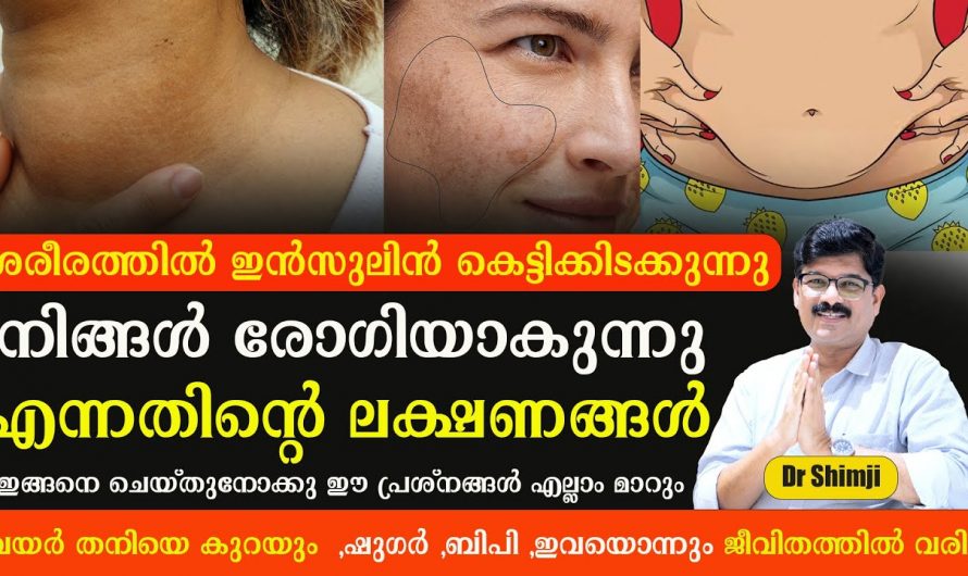 ഇത്തരം കാര്യങ്ങൾ ശ്രദ്ധിച്ചില്ലെങ്കിൽ നിങ്ങൾ  നിത്യരോഗിയായി മാറും.