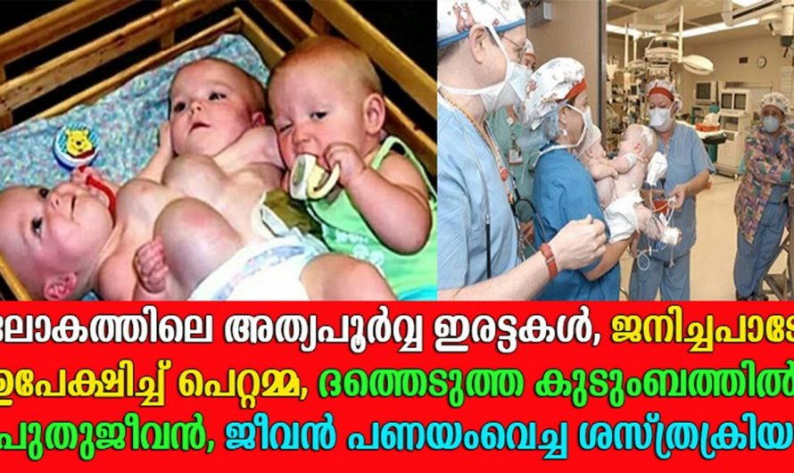 ഡോക്ടർ അസാധ്യമെന്ന് വിധിയെഴുതിയാൽ പിന്നീട് ഇവരുടെ ജീവിതത്തിൽ സംഭവിച്ചത്…