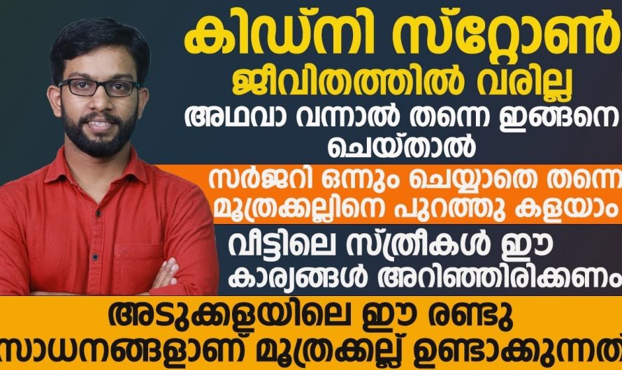 ഈ ഒരു കാര്യം ചെയ്താൽ കിഡ്നി സ്റ്റോൺ പൂർണ്ണമായും ഇല്ലാതാക്കാനും ഇനി ഒട്ടും  വരികയുമില്ല.. 👌