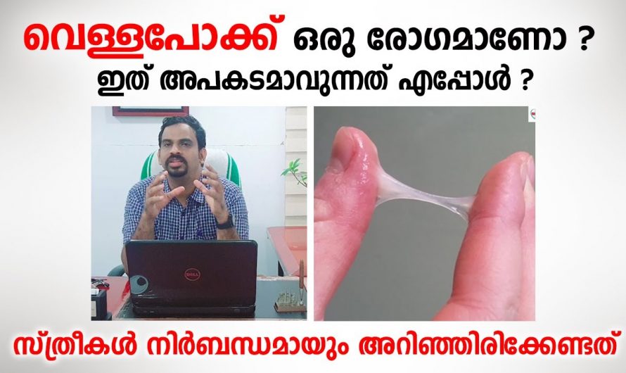 സ്ത്രീകൾ പുറത്തു പറയാൻ മടിക്കുന്ന ഈ രോഗത്തിന്റെ സത്യാവസ്ഥ എന്ത് 🤔