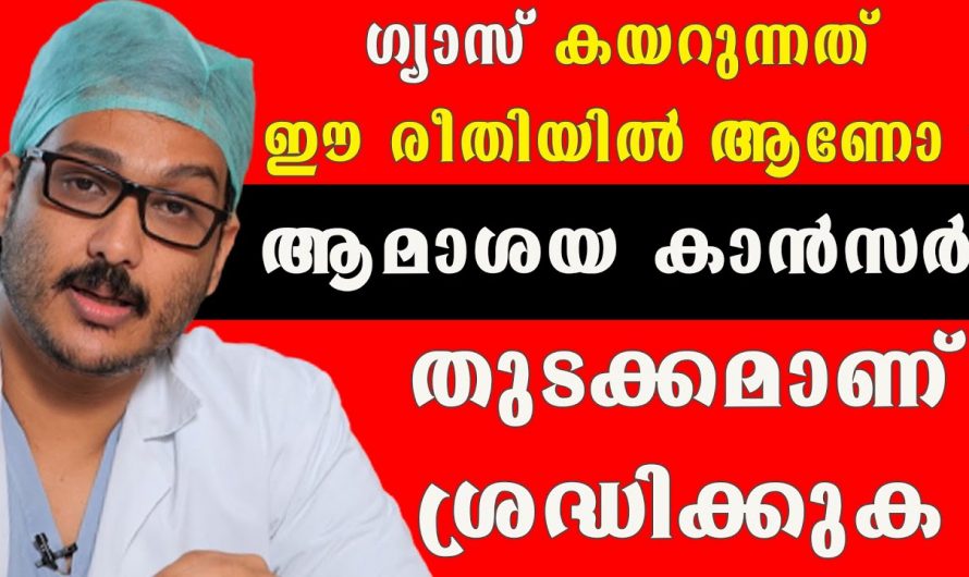 ഇത്തരം ലക്ഷണങ്ങൾ ആമാശയ ക്യാൻസറിന്റെ ആയിരിക്കും….😱