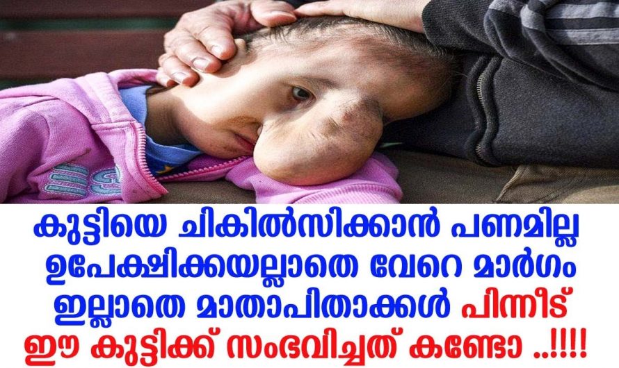 ദൈവത്തിന്റെ ഓരോ സൃഷ്ടികൾ കണ്ടാൽ ഞെട്ടിപ്പോകും…😱