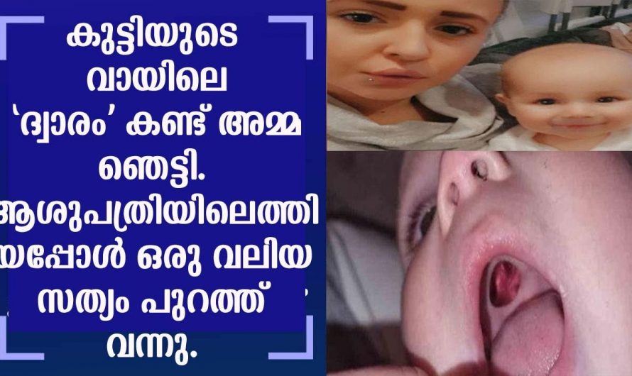 മകന്റെ വായിൽ ദ്വാരം കണ്ടാ അമ്മ ഞെട്ടി എന്നാൽ യഥാർത്ഥത്തിൽ സംഭവിച്ചത് ഇങ്ങനെ..😱