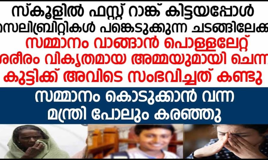 പൊള്ളലേറ്റി വികൃതമായ അമ്മയ്ക്ക് തുണയായത് ഈ മകൻ എങ്ങനെയാണെന്ന് കണ്ടോ..